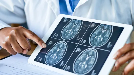 Doctor pointing to brain scans