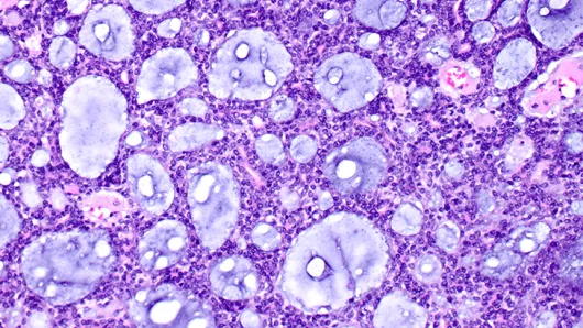 Pathology