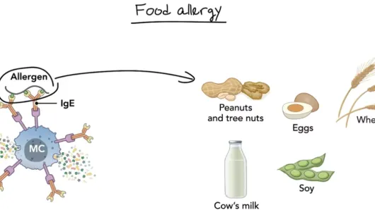 Allergy and asthma