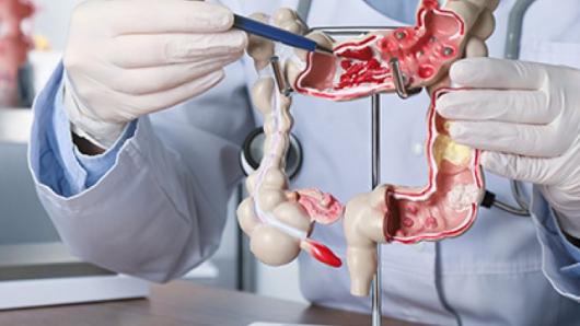 A person looking at a model of an intestine.