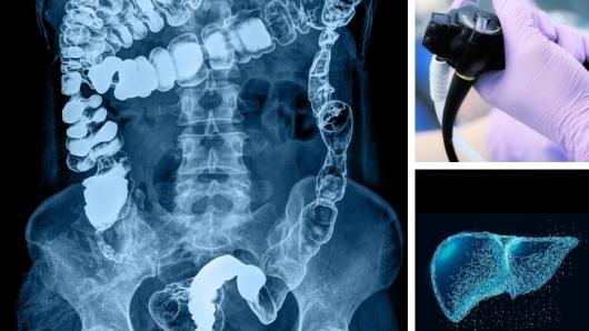An X-ray of the intestines.