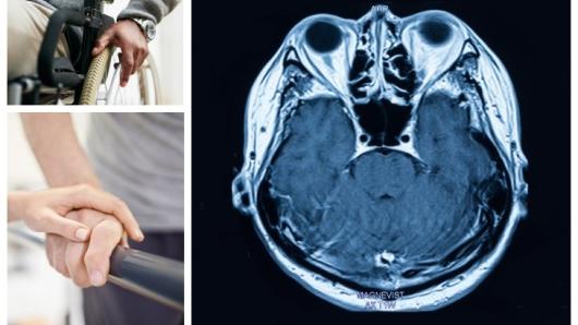 A CT scan of a brain.