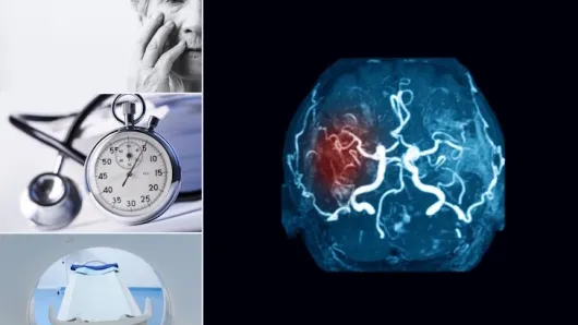 Brain with mass, confused woman, ticking stopwatch, MRI machine.