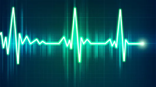 EKG illustration.