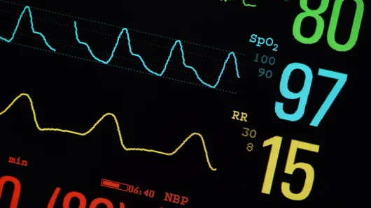 Hospital monitor.