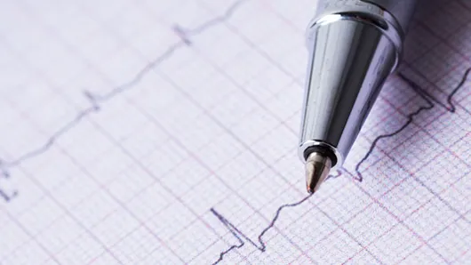 EKG