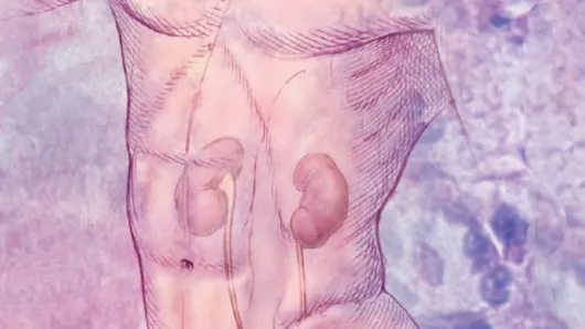 nephrology