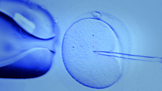 in-vitro fertilization under a microscope.